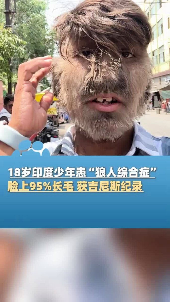 国产精品h自拍的相关介绍